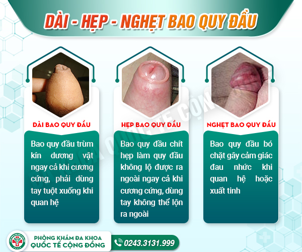 Thuốc bôi bao quy đầu có phải giải pháp hỗ trợ điều trị bệnh toàn diện?
